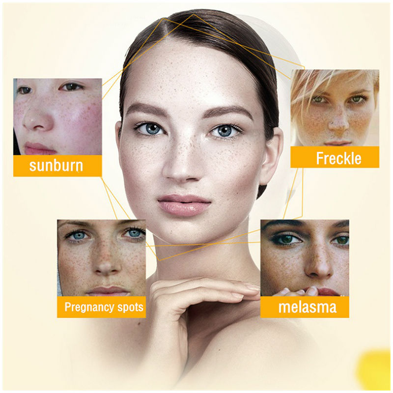 Dimollaure 美白そばかすクリーム保湿引き締め抗しわ - Skincare Herbal のレビューと価格