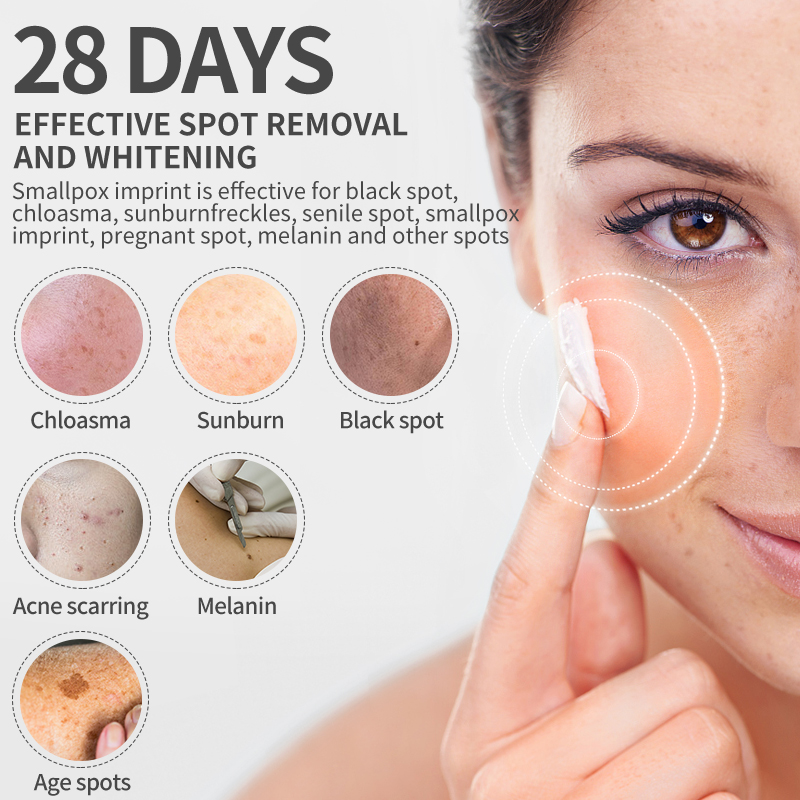 Dimollaure 美白そばかすクリーム保湿引き締め抗しわ - Skincare Herbal のレビューと価格