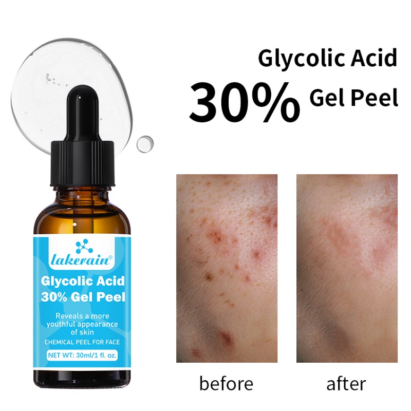 アンチエイジンググリコールジェル,アンチエイジングジェル,フ - Lactic Acid Toner のレビューと価格